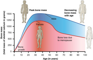Bone density peaks at about 30 years of age. Women lose bone mass more rapidly than men